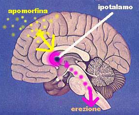 DISFUNZIONE ERETTILE: la terapia con apomorfina