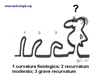 Le curvature del pene